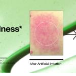 ANUA Azelaic Acid 10 Hyaluron Redness Soothing Serum 30ml